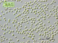 Diplosphaera chodatii