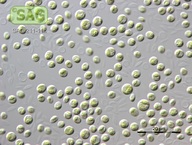 Chlorella vulgaris