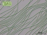 Anabaena torulosa