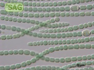 Anabaena torulosa