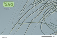 Gloeotrichia longicauda