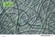 Gloeotrichia longicauda