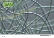 Gloeotrichia longicauda