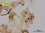 Anthophysa vegetans