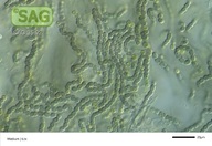 Nostoc spec.
