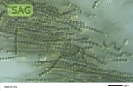 Nostoc spec.