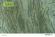 Nostoc spec.