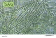 Nostoc spec.