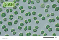 Cyanoptyche gloeocystis