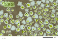 Scenedesmus hindakii