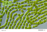 Ulothrix mucosa