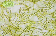 Stichococcus bacillaris