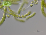 Ophiocytium maius